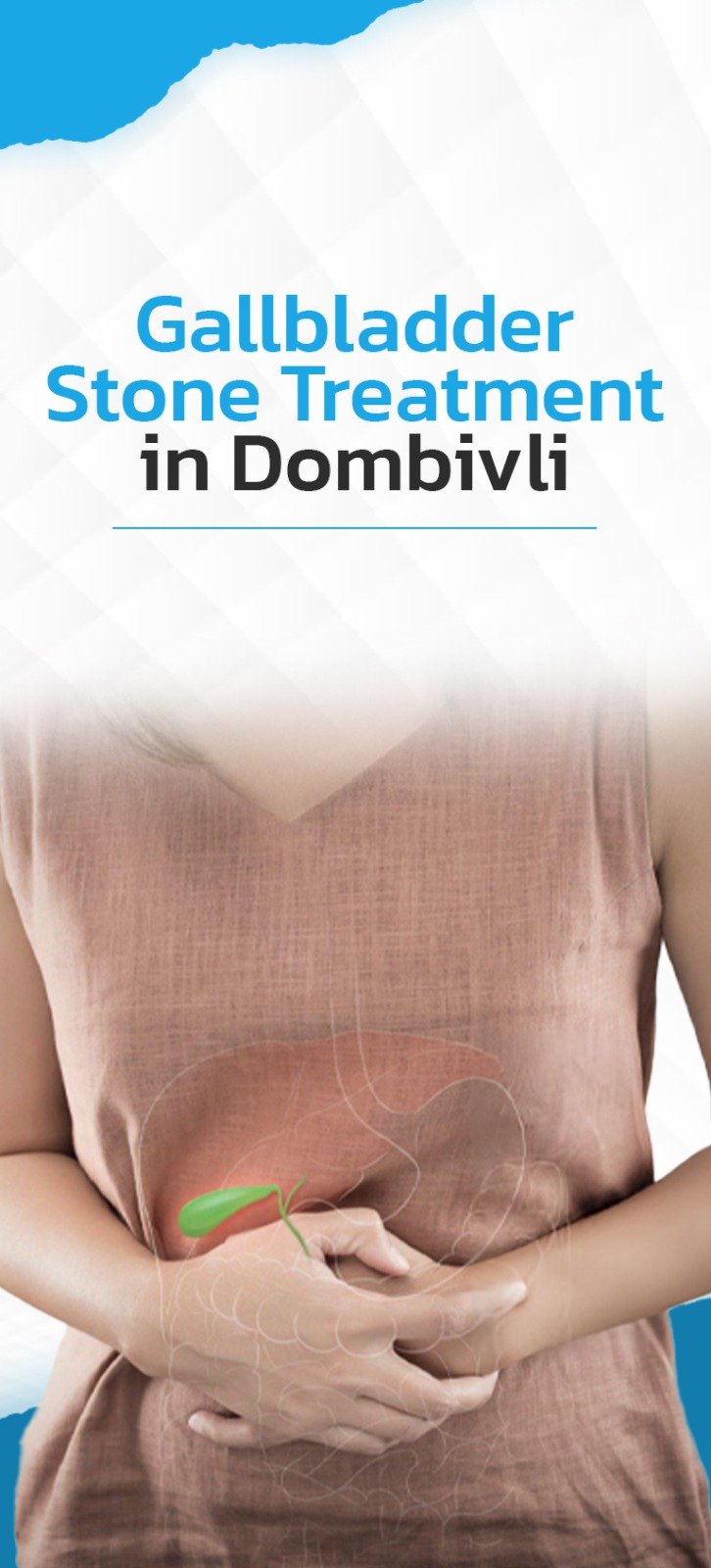 Gallbladder Stone Treatment in Dombivli