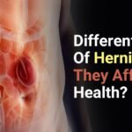 Hernias And How They Affect