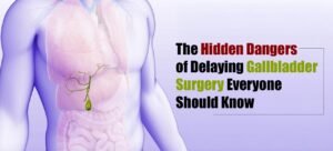 Hidden Dangers of Delaying Gallbladder Surgery Everyone Should Know