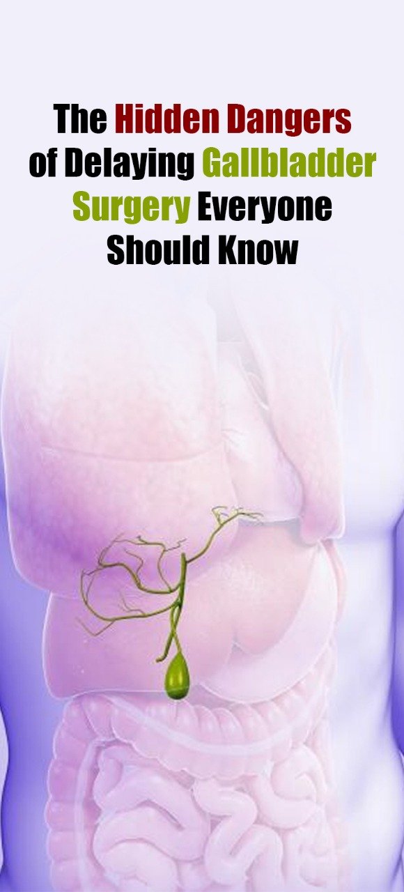 Gallbladder Surgery Everyone Should Know