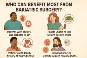 Bariatric Surgerysss