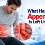 What Happens If Appendicitis Is Left Untreated (1)