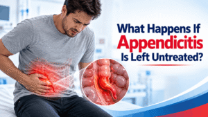 What Happens If Appendicitis Is Left Untreated (1)