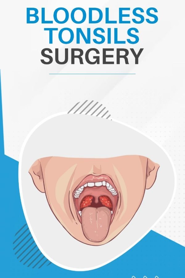 Blood Tonsils Surgery