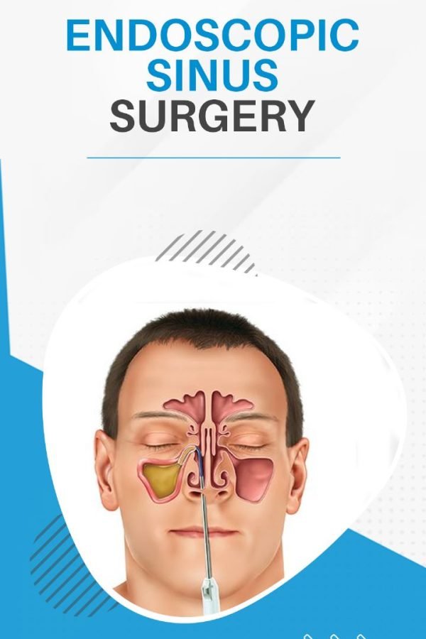 Endoscopy Sinus surgery